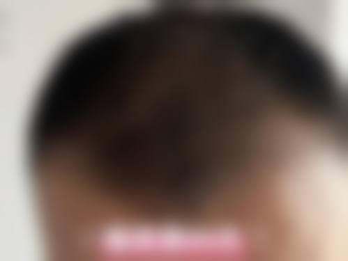 杭州薇熙颜整形医院收费价格表