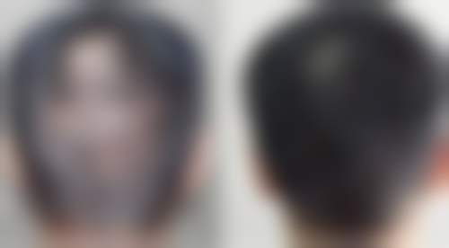 董远医生项目收费价格