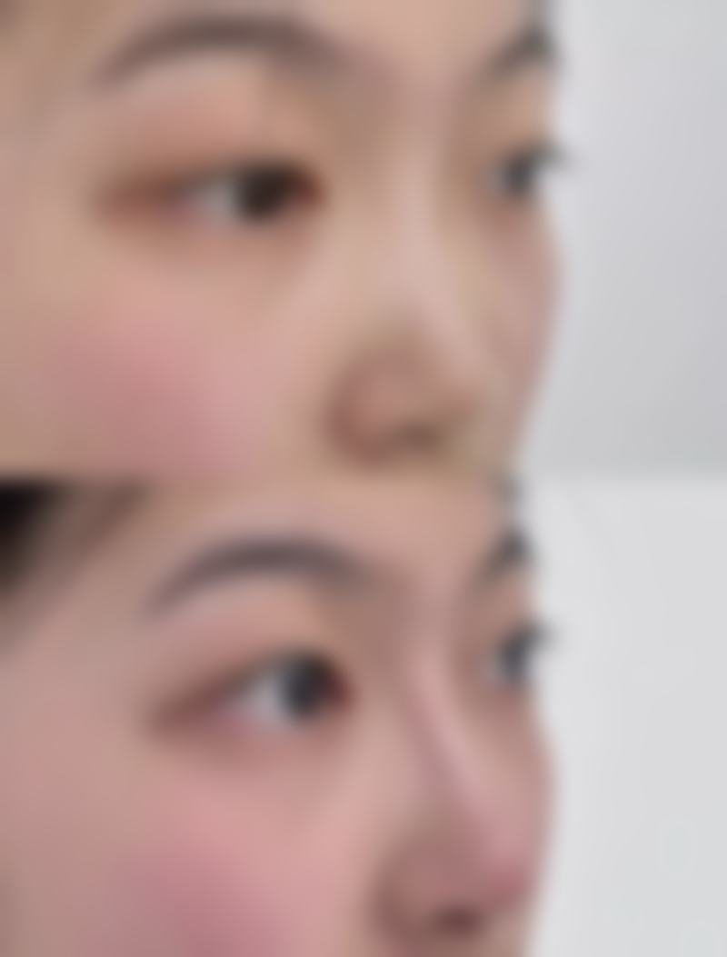 北京一美医疗美容医院收费价格表