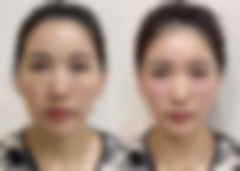 重庆美丽佳人医疗美容门诊部收费价格表