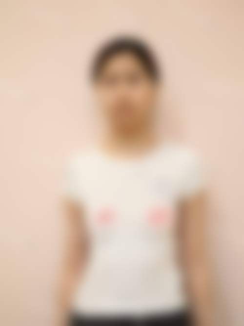 郑州爱美忻医疗美容门诊部价格表