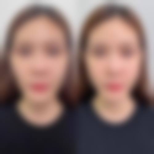 韩国毛多毛modumo医院（原布莱克）预约挂号方式