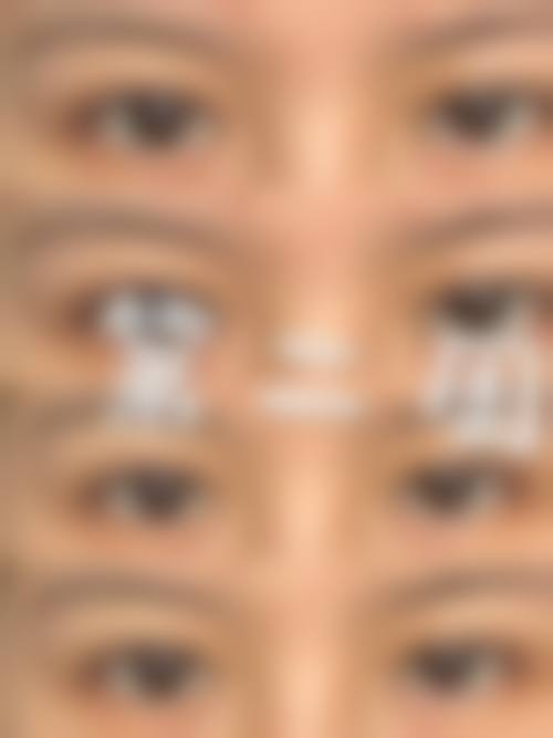 赵长善医生技术优势