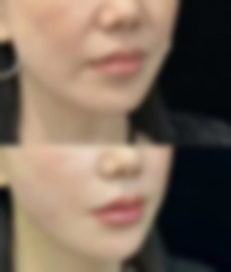 义乌美卓医疗美容门诊部收费价格表