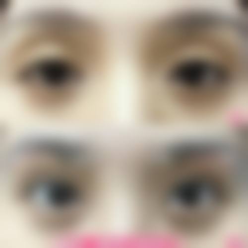 贵阳云岩碧美斯医疗美容诊所收费价格表