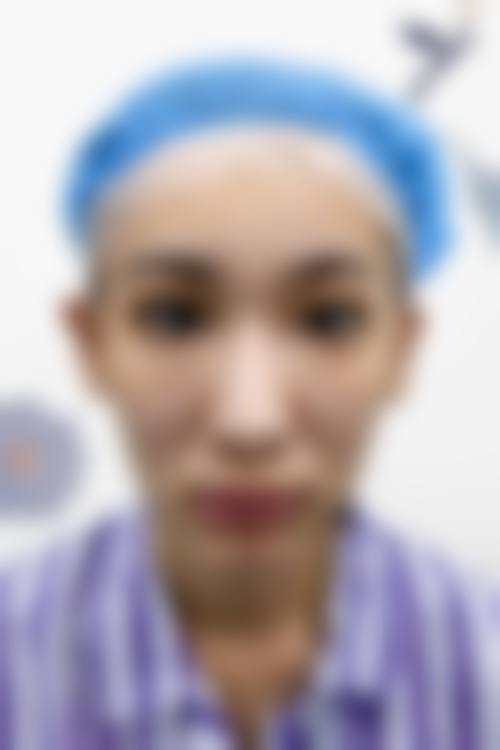 袁青医生预约挂号