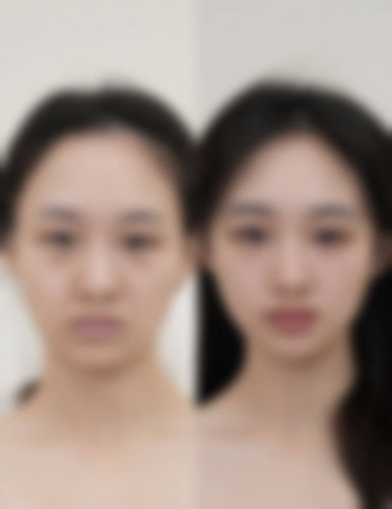 邢昊昺医生项目收费价格