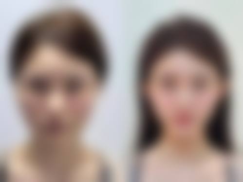 荆州素美熙四良整形医院收费价格表