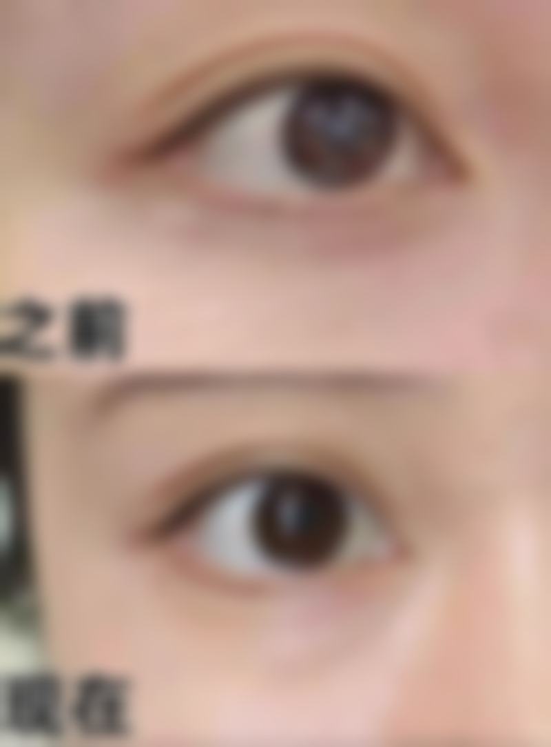 黄循镭医生口碑评价及反馈内容