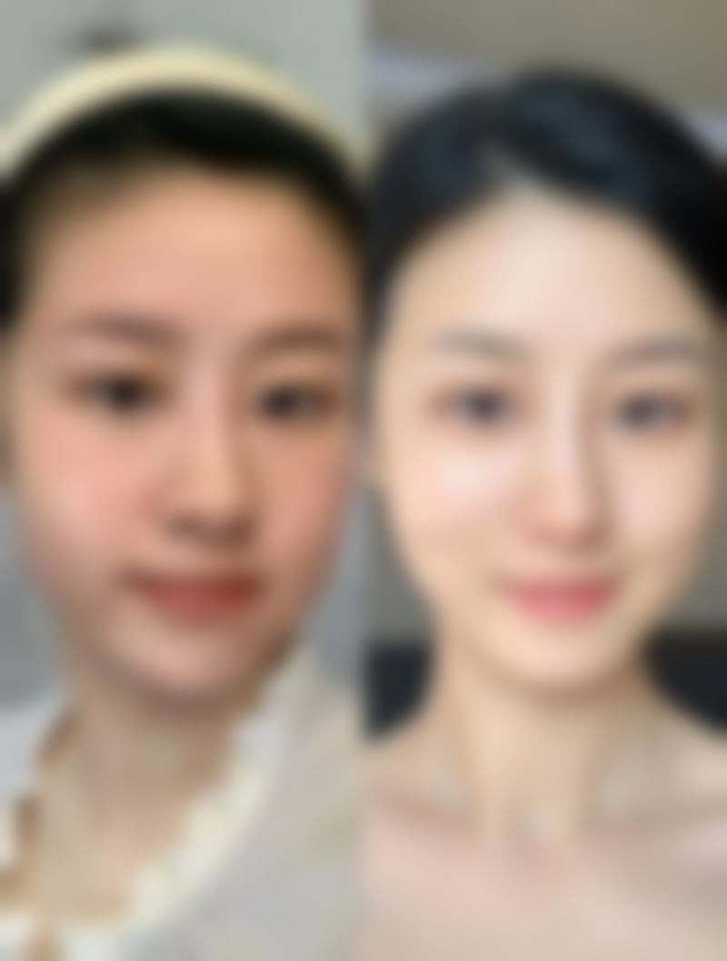 泉州丰泽中科医院皮肤美容科收费价格表