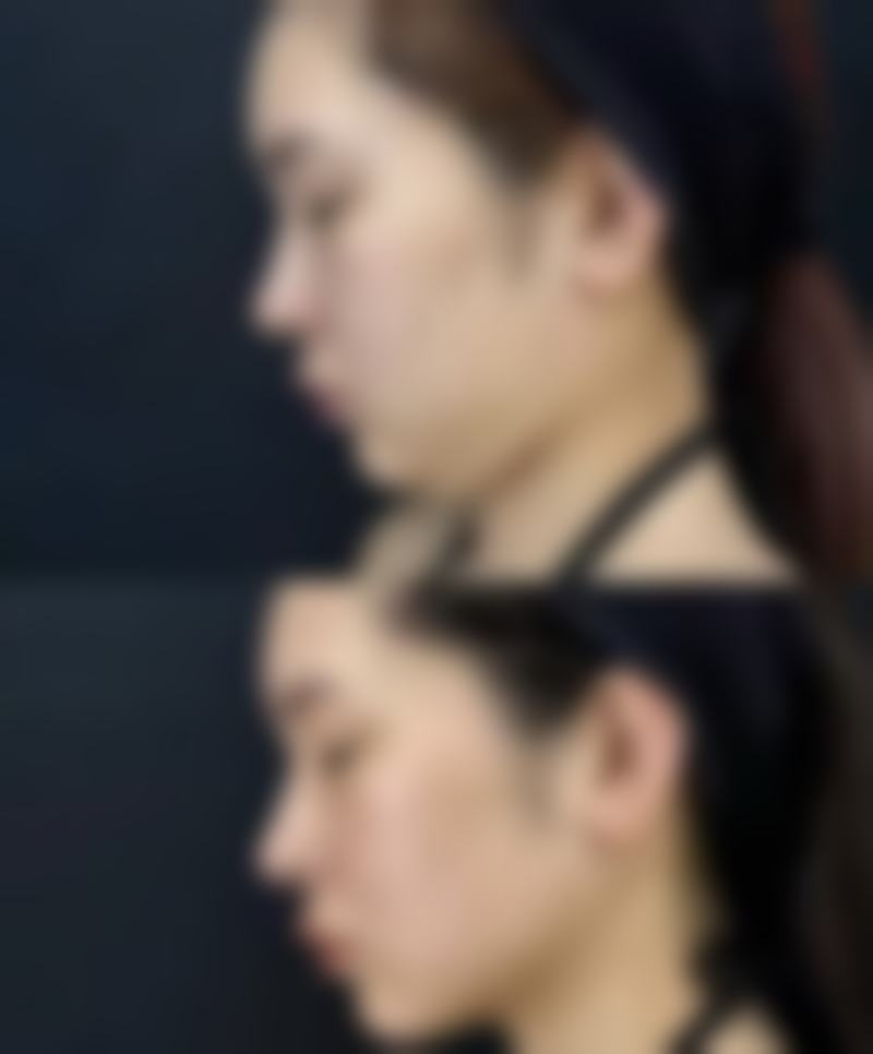 周立意医生技术优势