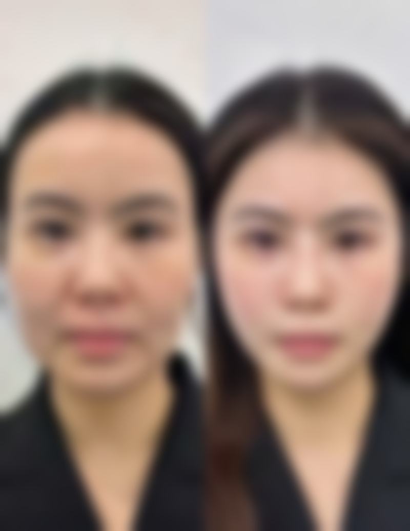 赫雪飞医生预约挂号
