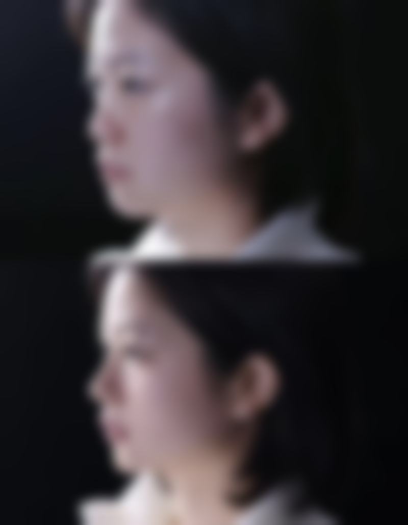 哈尔滨市第五医院(烧伤三病区(整形美容科))收费价格表