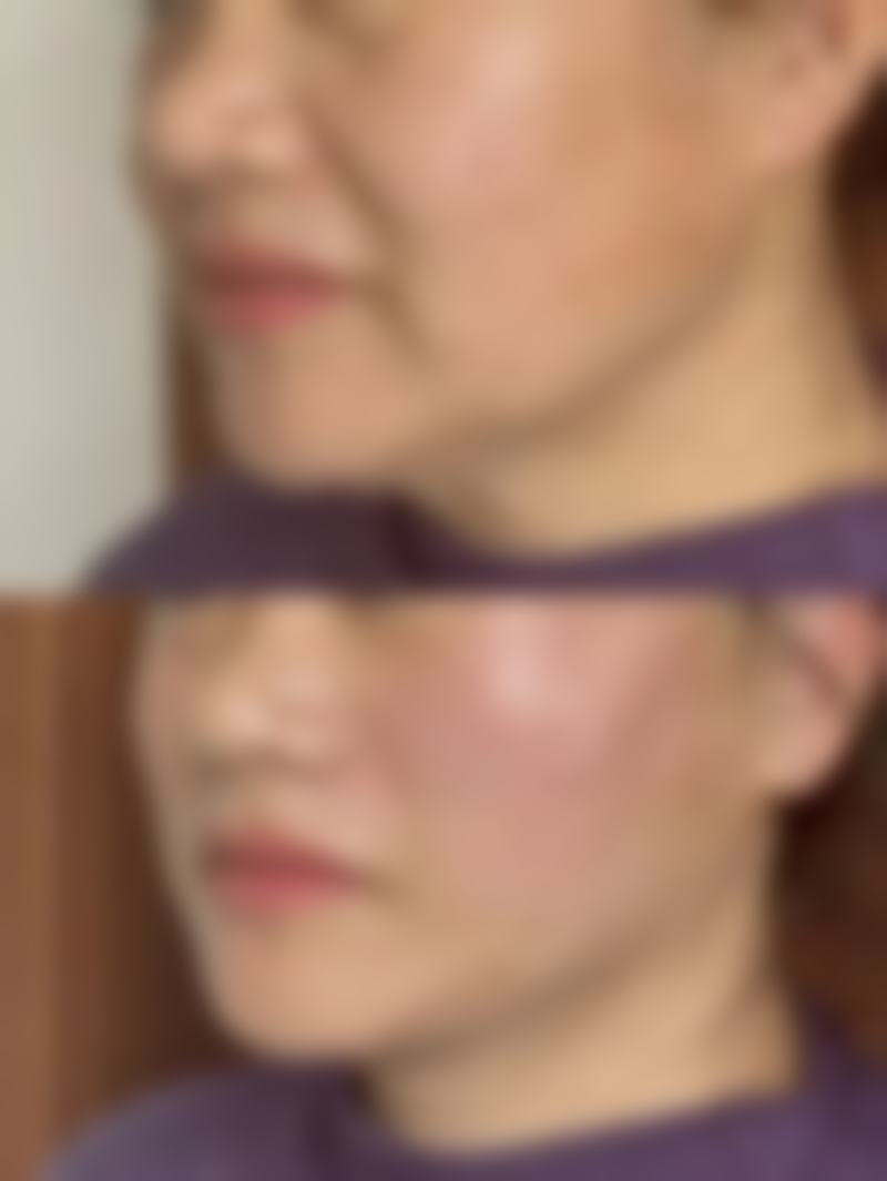韩国Abijou雅秘珠皮肤科收费价格表