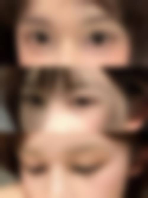 鲍雪梅医生项目收费价格