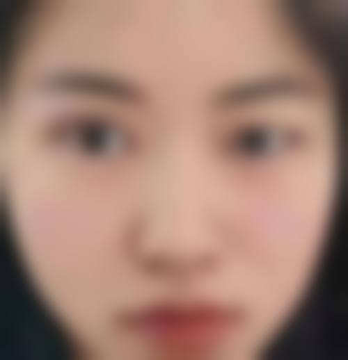 鲍雪梅医生技术优势