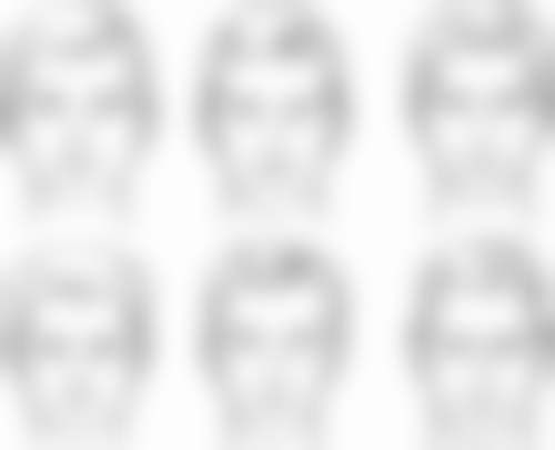 七、哈尔滨医 大第四整形医院口碑好不好？附真实患者口碑评价