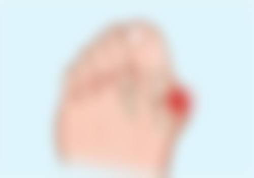 陈卫华医生技术优势