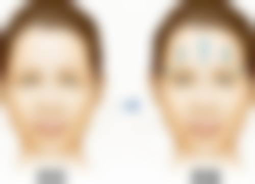 石承瓒医生技术优势