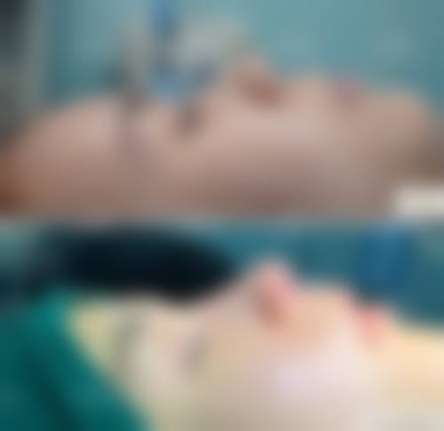 张睅理医生技术优势