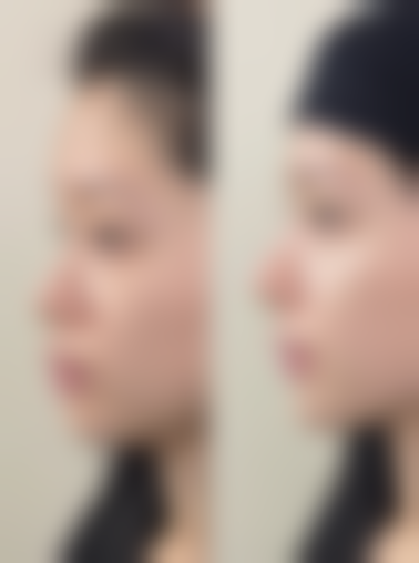 长冈SkinClinic收费价格表