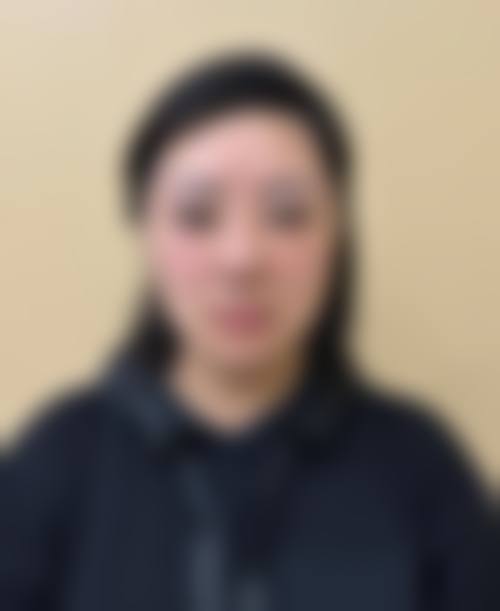 王美水医生项目收费价格