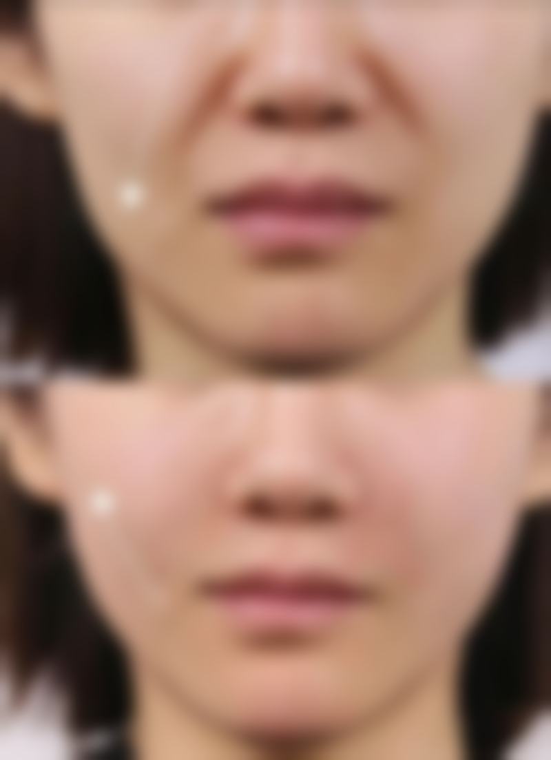 闫寿健医生技术优势
