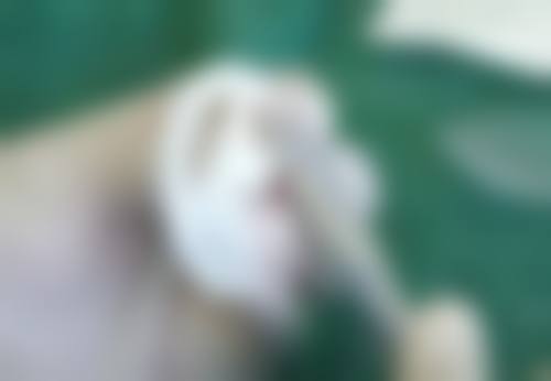 于秀英医生技术优势