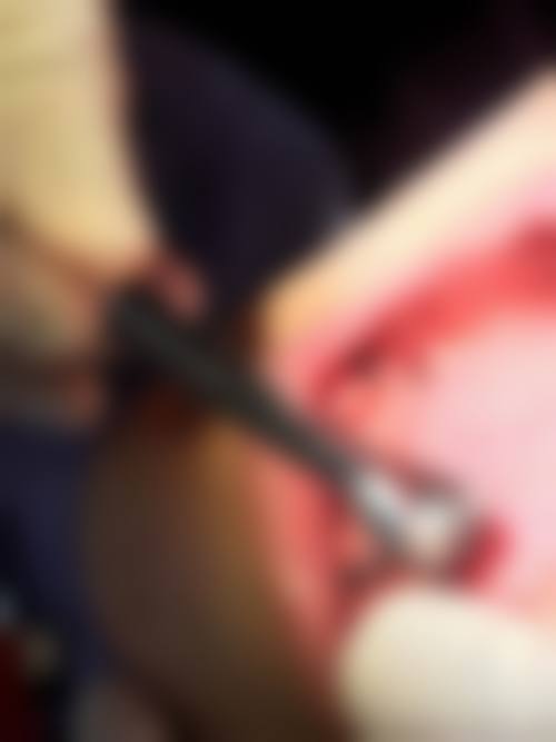 临床实例分享