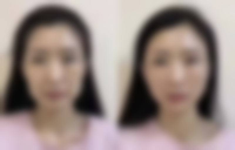 尹莉医生预约挂号