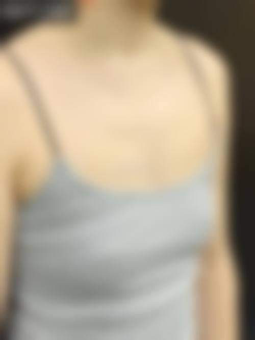 特色整形项目与价格参考