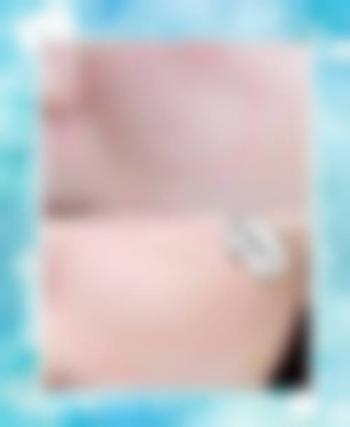 精良设备与层流手术环境