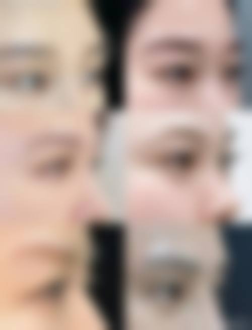 临床实例分享