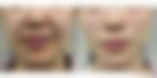 常见问题FAQ
