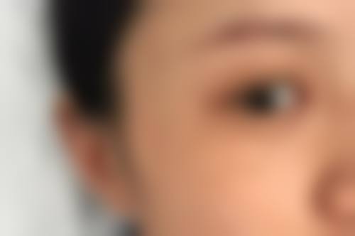 临床实例分享