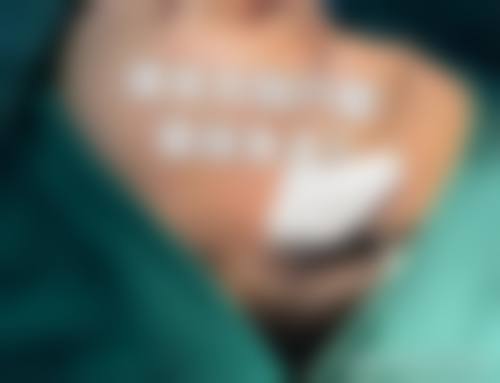 患者真实评价
