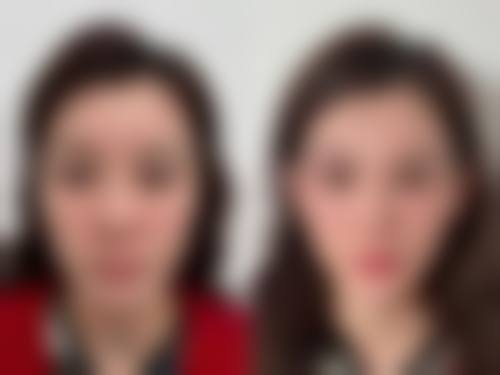 特色整形项目:满足个性化变得更美需求