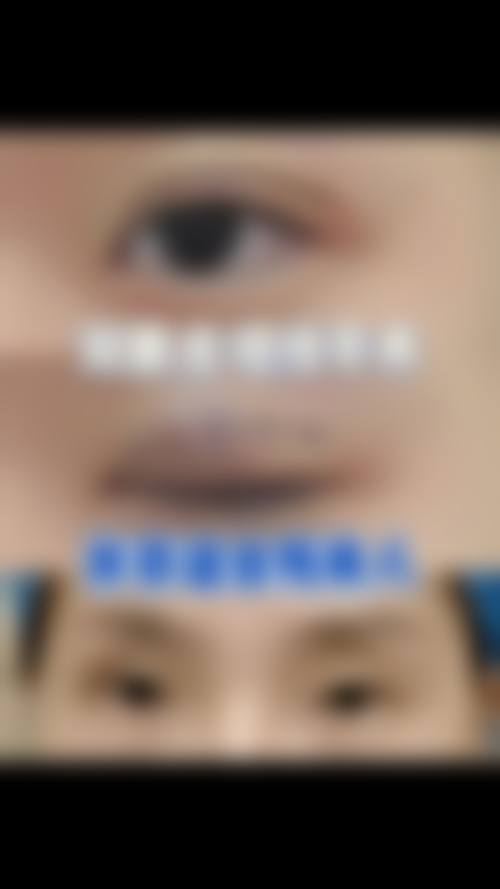 优惠活动详情:限时补贴与项目价格参考
