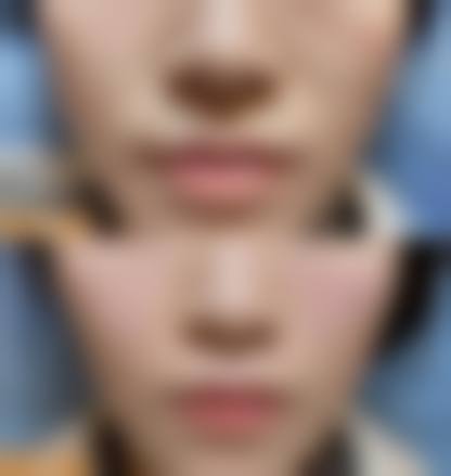 临床实例分享:真实改善,见证医术
