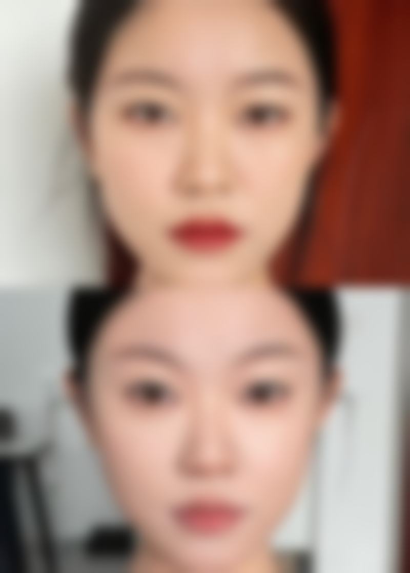 仪器抗衰:科技赋能,轻松焕活年轻肌