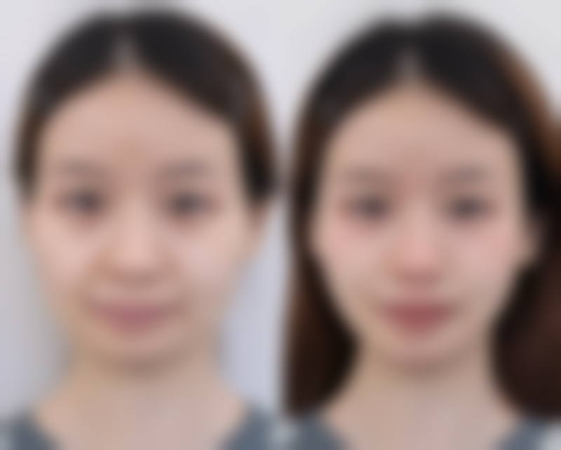 FAQ:您关心的热门问题