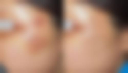 黄泽景医生口碑评价及反馈内容