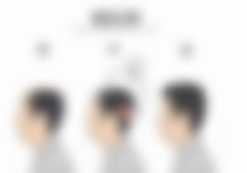 沈阳毛发移植及再生研究中 心特色诊疗项目与技术优势