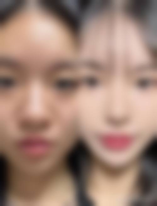 擅长项目详解