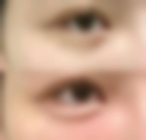 临床实例分享