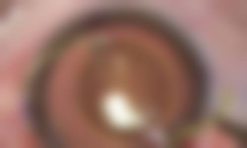 患者真实评价:好口碑,看得见