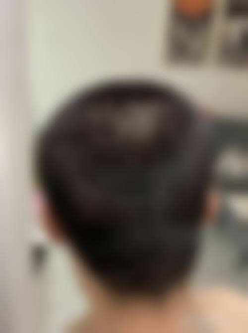 沈阳毛发移植及再生研究中 心地址电话、营业时间