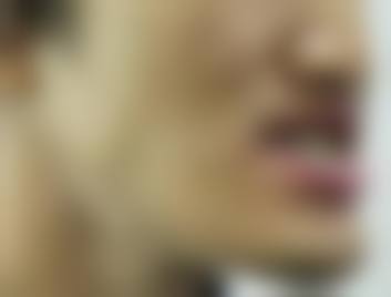 临床实例分享