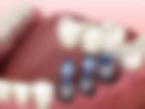 医院资质与实力:正规口腔机构值得信赖
