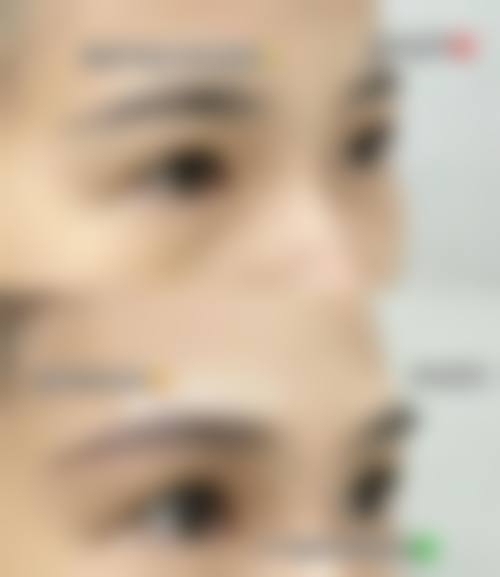 患者保护与术后维护
